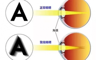 有散光怎么戴隐形眼镜，有散光能戴隐形眼镜吗